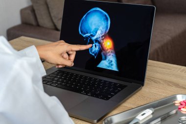 Doctor showing a x-ray of pain in the brain. Migraine Headache concept. High quality photo