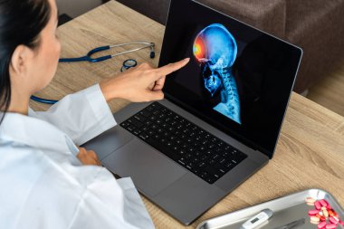 Doctor showing a x-ray of pain in the brain. Migraine Headache concept. High quality photo