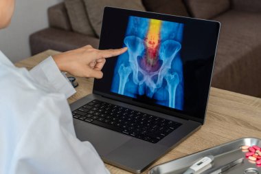 Doctor looking a x-ray of pain in the spine. Backache trauma. High quality photo