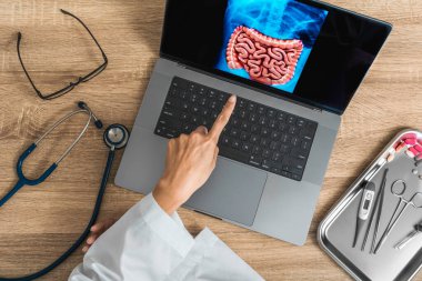 Doctor showing a x-ray of stomach and intestine. High quality photo