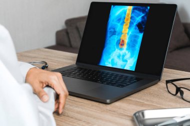 Doctor looking a x-ray of pain in the spine. Backache trauma. High quality photo