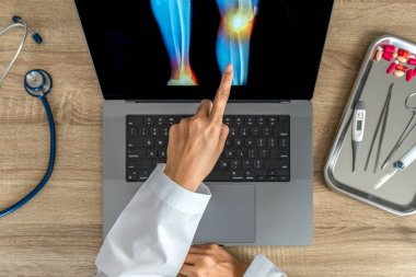 Top view of doctor showing a x-ray of pain in the knee. High quality photo