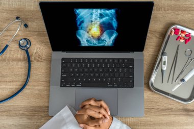 Doctor looking a x-ray of pain in the spine. Backache trauma. High quality photo