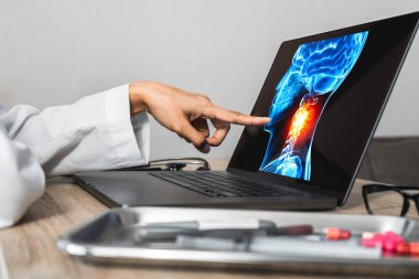 Doctor showing a x-ray of pain in the brain. Migraine Headache concept. High quality photo