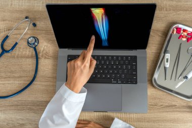 Top view of doctor showing a x-ray of pain in the knee. High quality photo