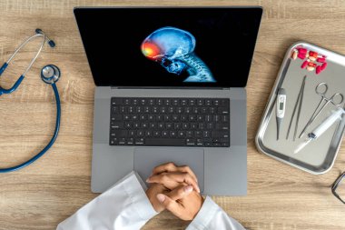 Top view of doctor looking a x-ray of pain in the brain on a laptop. Migraine Headache concept. High quality photo