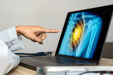 Doctor showing a x-ray of pain in the ribs. Heart attack or chest injury. High quality photo