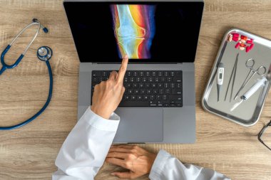 Top view of doctor showing a x-ray of pain in the knee. High quality photo