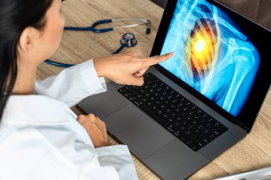 Doctor showing a x-ray of pain in the ribs. Heart attack or chest injury. High quality photo