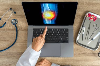 Top view of doctor showing a x-ray of pain in the knee. High quality photo