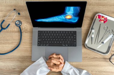 Top view of doctor looking a x-ray of foot. Pain ankle injury. High quality photo