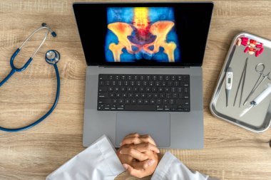 Top view of doctor looking a x-ray of pain in the hips on a laptop. . High quality photo