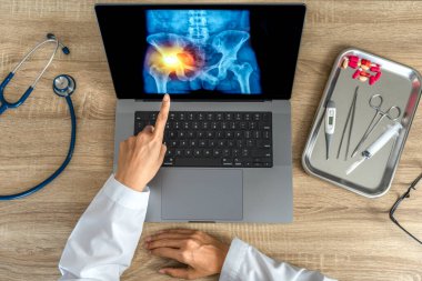 Top view of doctor looking a x-ray of pain in the hips on a laptop. . High quality photo