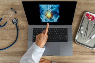 Doctor showing a x-ray of pain in the spine. Backache trauma. High quality photo