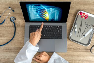 Doctor showing a x-ray of pain in the ribs. Heart attack or chest injury. High quality photo