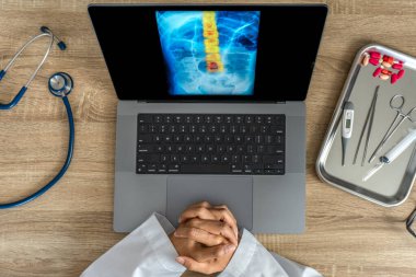 Doctor looking a x-ray of pain in the spine. Backache trauma. High quality photo