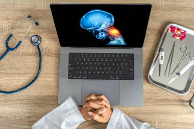 Top view of Doctor looking a x-ray of pain in the neck. Migraine Headache and backache. . High quality photo