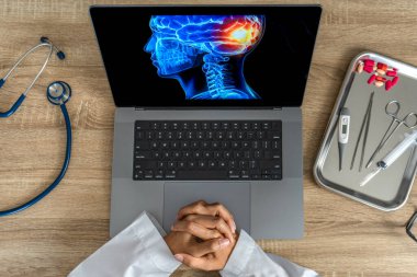 Top view of doctor looking a x-ray of pain in the brain on a laptop. Migraine Headache concept. High quality photo