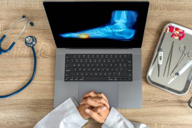 Top view of doctor looking a x-ray of foot. Pain injury. High quality photo