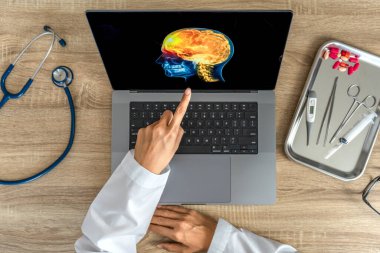 Top view of doctor looking a x-ray of pain in the brain on a laptop. Migraine Headache concept. High quality photo