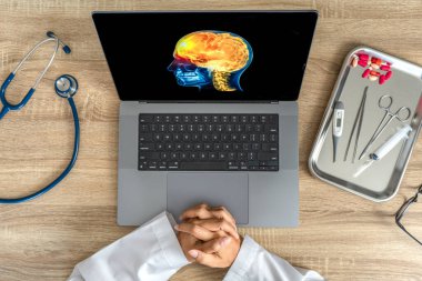 Top view of doctor looking a x-ray of pain in the brain on a laptop. Migraine Headache concept. High quality photo