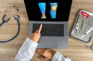 Top view of doctor showing a x-ray of pain in the knee. High quality photo