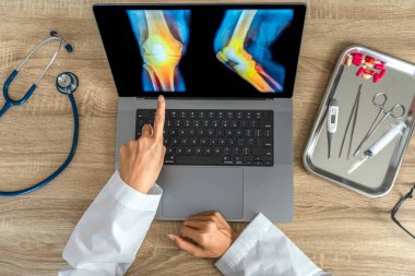 Top view of doctor showing a x-ray of pain in the knee. High quality photo