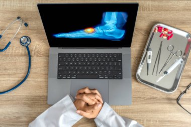 Top view of doctor looking a x-ray of foot. Pain injury. High quality photo