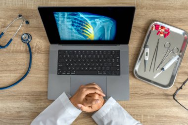 Doctor looking a x-ray of pain in the ribs. Heart attack or chest injury. High quality photo