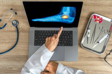 Top view of doctor showing a x-ray of foot. Pain ankle injury. High quality photo