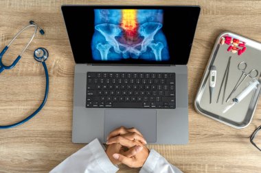 Doctor looking a x-ray of pain in the spine. Backache trauma. High quality photo