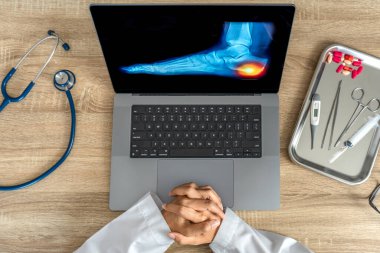 Top view of doctor showing a x-ray of foot. Pain heel and foot injury. High quality photo