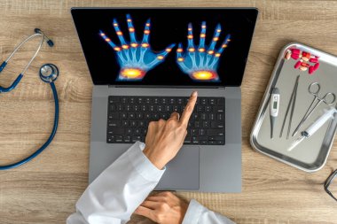 Top view of doctor showing x-ray of hands. High quality photo