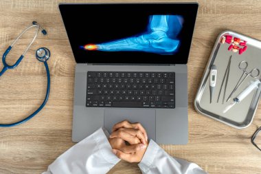 Top view of doctor showing a x-ray of foot. Pain toes injury. High quality photo