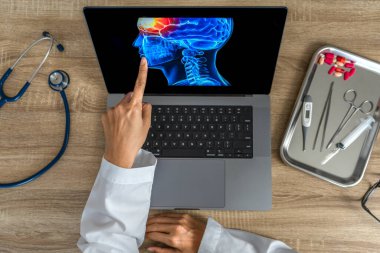 Top view of doctor looking a x-ray of pain in the brain on a laptop. Migraine Headache concept. High quality photo