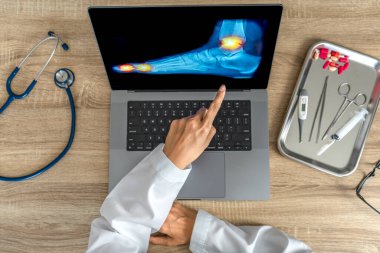 Close up of doctor showing a x-ray of foot. Pain ankle and foot injury. High quality photo