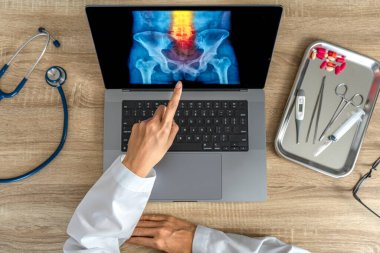 Doctor showing a x-ray of pain in the spine. Backache trauma. High quality photo