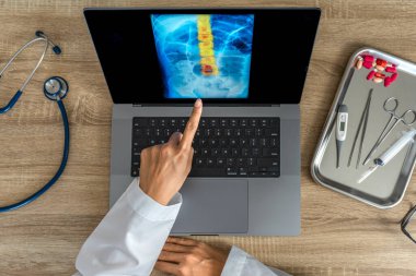 Doctor showing a x-ray of pain in the spine. Backache trauma. High quality photo