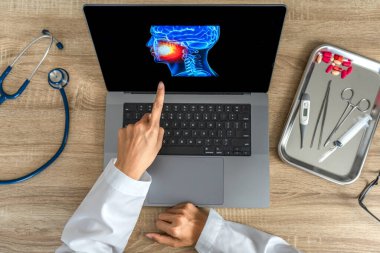 Dentist showing a x-ray of pain in the mouth. High quality photo