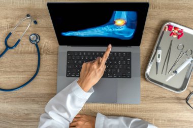 Top view of doctor showing a x-ray of foot. Pain ankle injury. High quality photo