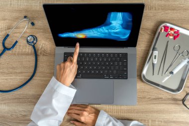 Top view of doctor showing a x-ray of foot. Pain injury. High quality photo