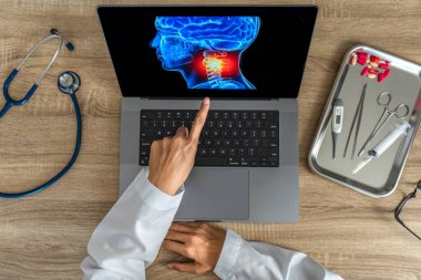 Top view of Doctor showing a x-ray of pain in the neck. Migraine Headache and backache. . High quality photo