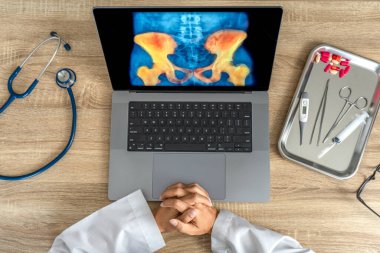 Top view of doctor looking a x-ray of pain in the hips on a laptop. . High quality photo