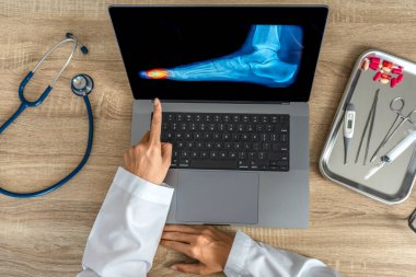 Top view of doctor showing a x-ray of foot. Pain toes injury. High quality photo