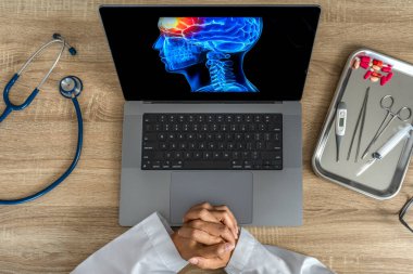 Top view of doctor looking a x-ray of pain in the brain on a laptop. Migraine Headache concept. High quality photo