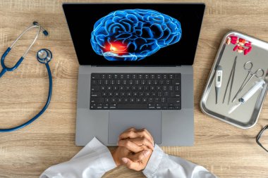 Top view of doctor looking a x-ray of pain in the brain on a laptop. Migraine Headache concept. High quality photo