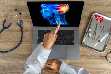 Top view of doctor looking a x-ray of pain in the brain on a laptop. Migraine Headache concept. High quality photo