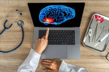 Top view of doctor looking a x-ray of pain in the brain on a laptop. Migraine Headache concept. High quality photo