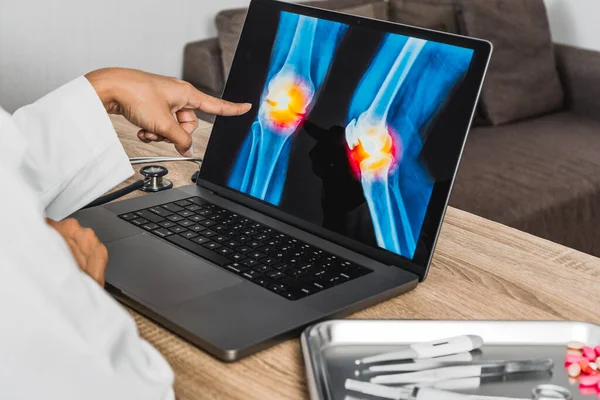 Close up of doctor showing a x-ray of pain in the knee. High quality photo