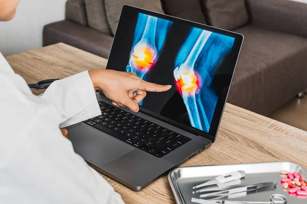 Close up of doctor showing a x-ray of pain in the knee. High quality photo